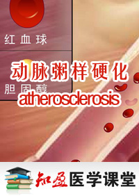 Ӳ(atherosclerosis)Ƶ