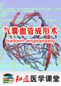 Ѫܳ(balloonangioplasty)Ƶ